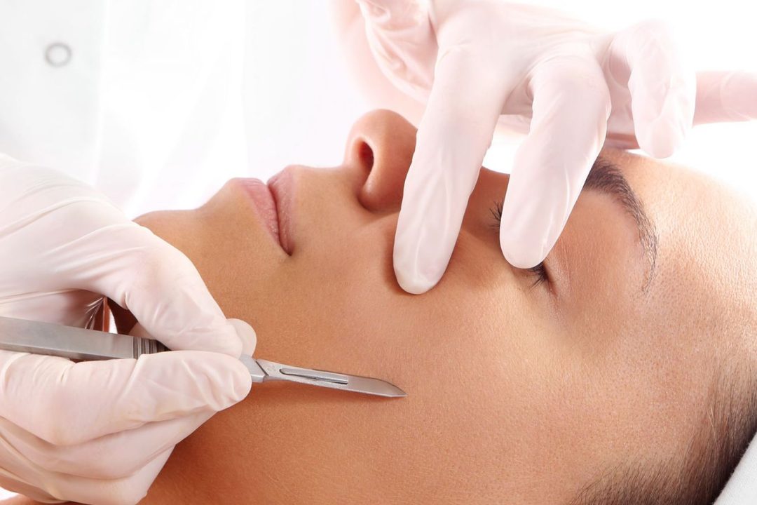 Dermaplaning